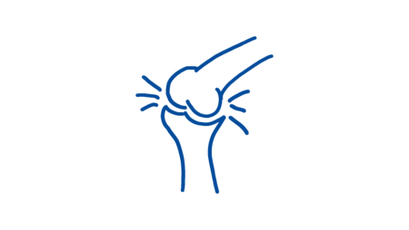 Skizze eines Knies mit Gelenk